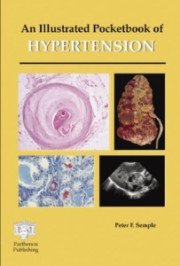 AN ILLUSTRATED POSKETBOOK OF HYPERTENSION