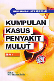 KUMPULAN KASUS PENYAKIT MULUT SERI 1