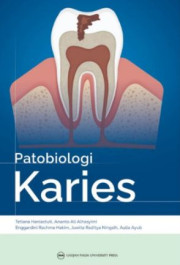 PATABIOLOGI KARIES