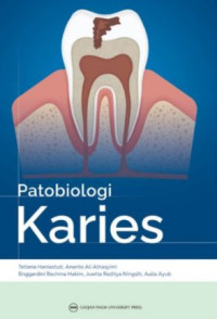 Image of PATABIOLOGI KARIES